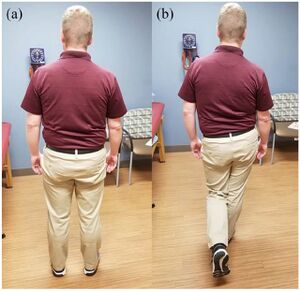 Trendelenburg test. The test is positive if the contralateral pelvis tilts downwards when asked to stand on the affected foot.