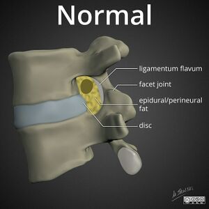 Lumbar-neuroforaminal-stenosis-normal.jpg