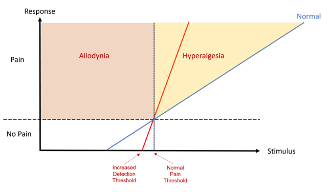 Hyperpathia with increased DT, normal PT, hyperalgesia, and steeper stimulus-response curve as compared to normal.