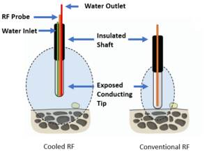 Cooled vs Conventional RF.png