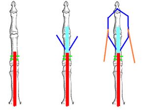 Figure 3: Extensor mechanism of the finger. In the drawing on the left the common extensor tendon is shown in red. It attaches to the proximal phalanx via bands and extends the MCP joint. In the center figure, the trifurcation is shown. the central slip, shown in sky blue, inserts on the middle phalanx and extends the PIP joint. The lateral bands are shown in blue. In the right-most drawing, the lateral bands are shown joined by the tendons of the interosseous and lumbrical muscles and inserting on the distal phalanx, thereby extending the DIP.