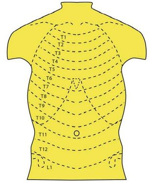 Figure 7.The segmental pattern of innervation of the chest and abdominal wall. Visceral pain is referred to areas with a shared segmental innervation.© Springer-Verlag Berlin Heidelberg 2007.