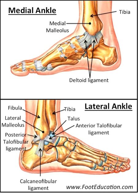Ankle Fractures (Tibia and Fibula) - WikiMSK