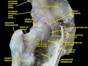 Hip anatomy cadaver.jpg