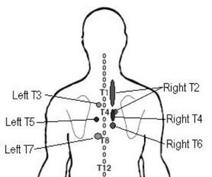Thoracic costotransverse joint pain patterns picture Young 2008.jpg